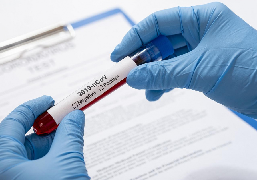 Внимание! Пройти тест на антитела к COVID-19 можно на станции переливания крови